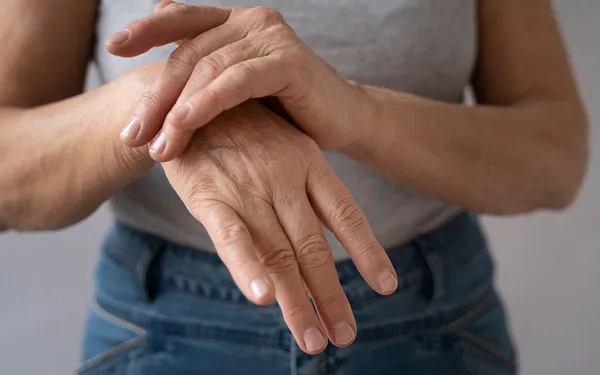 Nutrición y Artritis